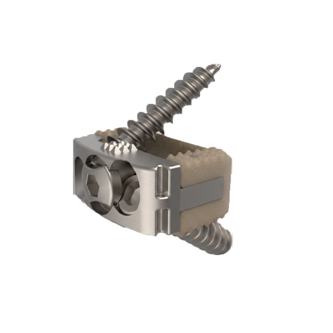 T-Lock Cervical Intervertebral Cage